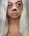 Nærbilde av blond kvinne med blåmerker rundt øynene og bandasje over nesen.
