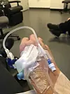 Nærbilde av en arm med medisinsk slange og koblinger i et klinikkrom.